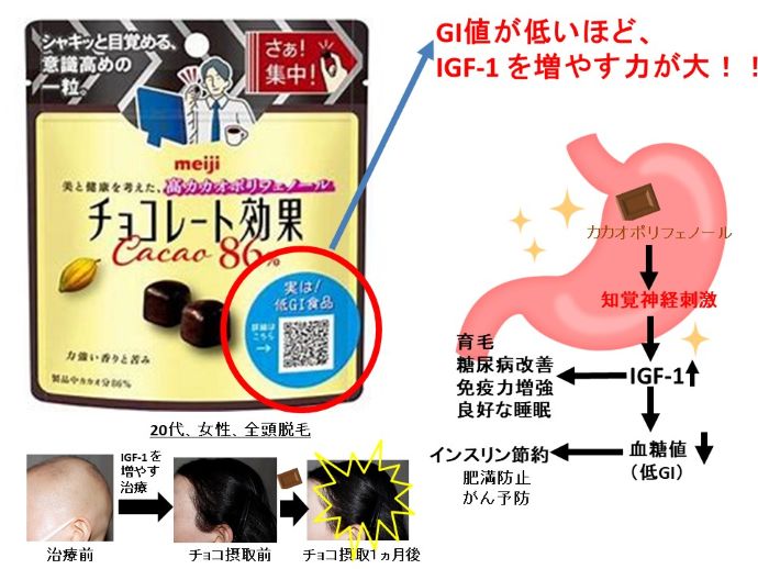 円形脱毛症　病院